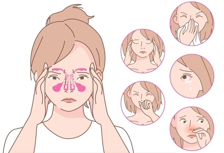 Симптомы аллергического ринита
