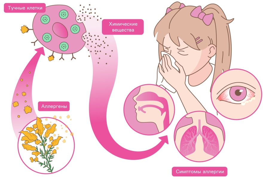 Механизм развития аллергической реакции у ребёнка