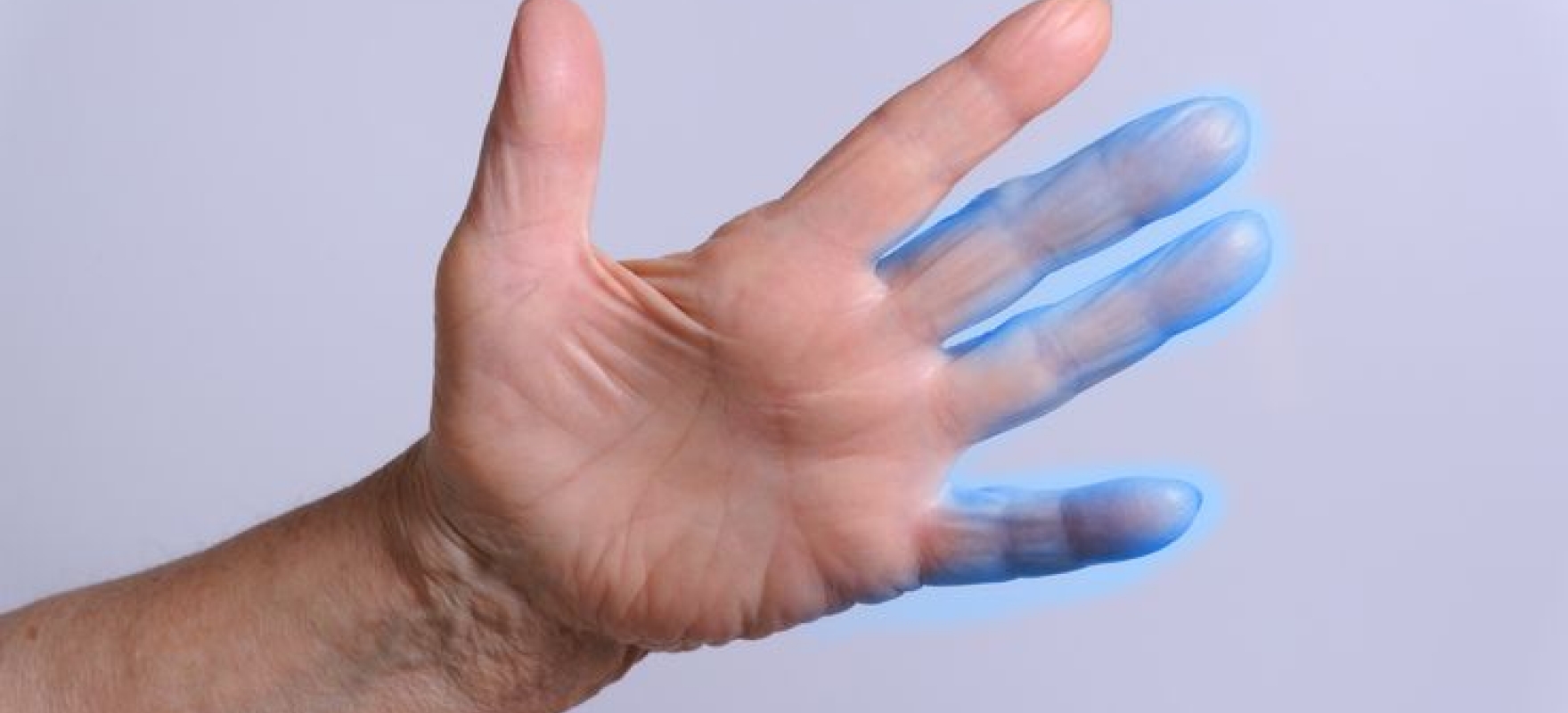 Химиотерапия немеют пальцы. Онемение пальцев парестезии. Онемение пальцев рук при анемии. Анемия покалывание пальцев.