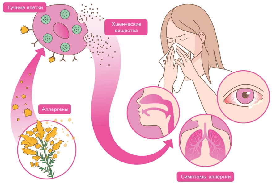 Механизм развития симптомов аллергии